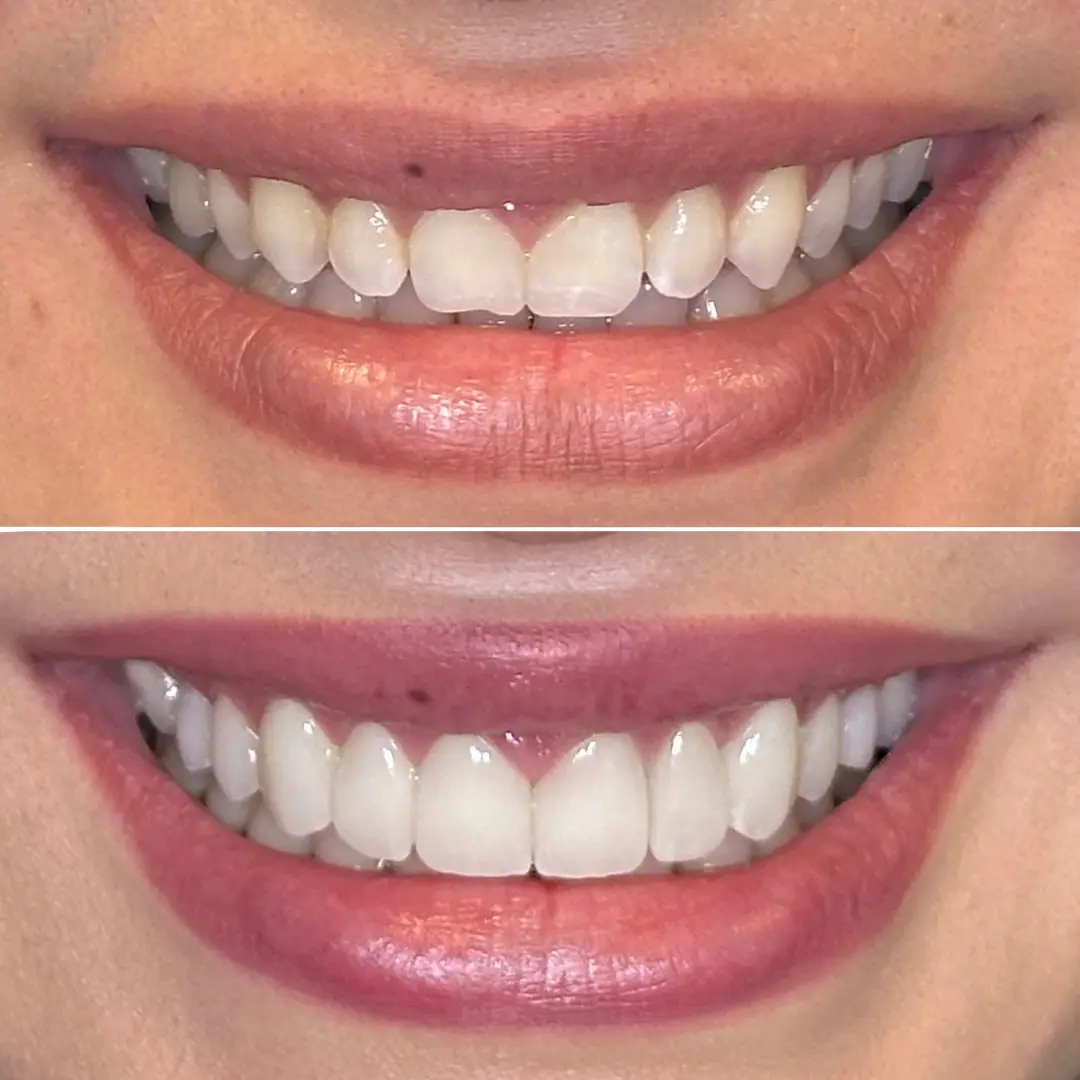 Waiting area at 32ology Dental Studio - Argina Kudaverdian, DDS, Tarzana, Tarzana