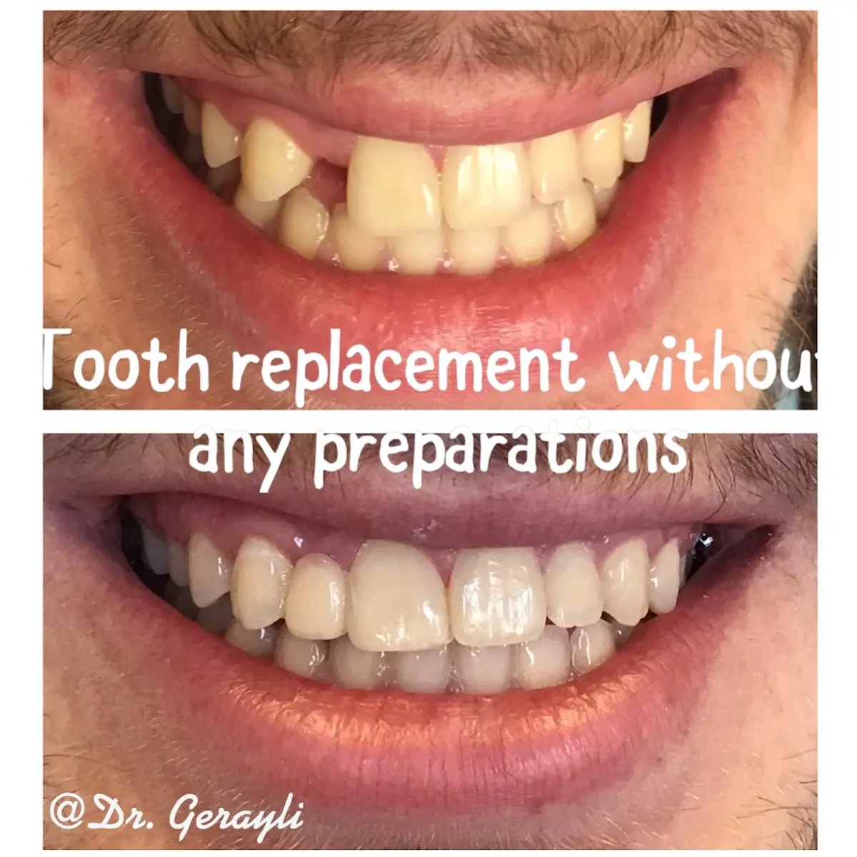 Chairside at Afsoon Gerayli DDS, Reseda, Reseda