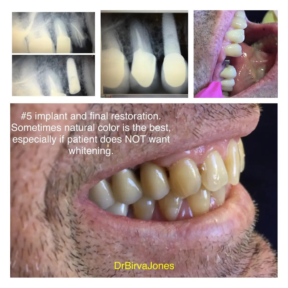 Treatment room at Birva B Joshi, DDS Inc aka Dr. Birva Joshi Jones, West Hills, West Hills