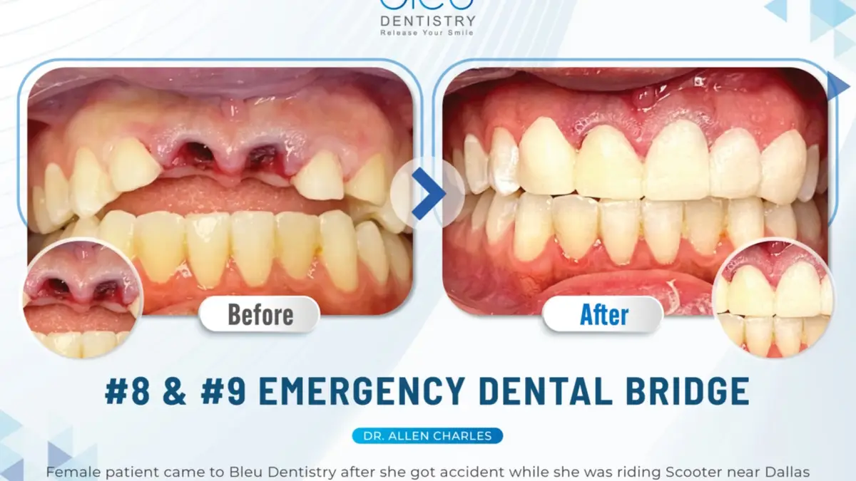 Inside Bleu Dentistry, Oak Lawn, Dallas