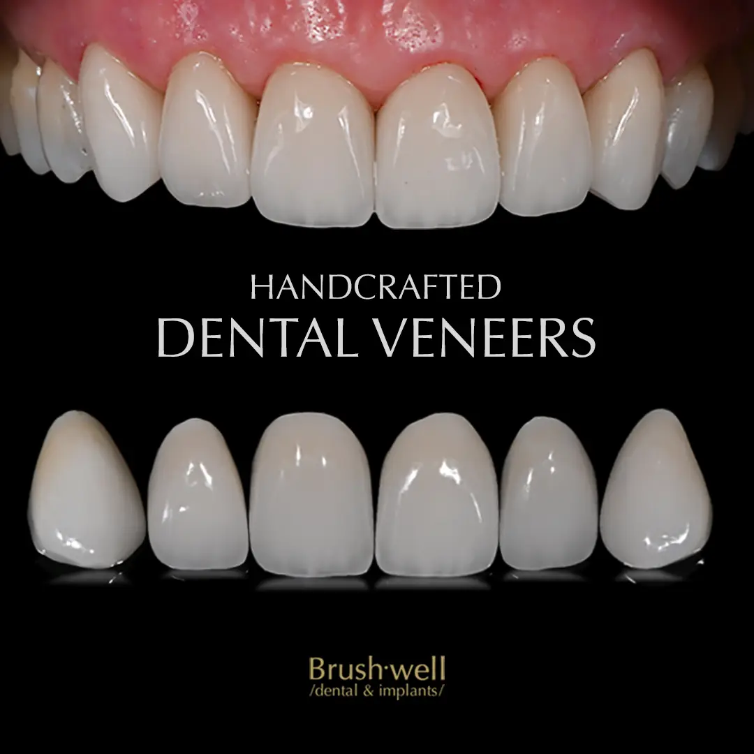 Front entrance of Brushwell Dental & Implants, Monterey Park, Monterey Park