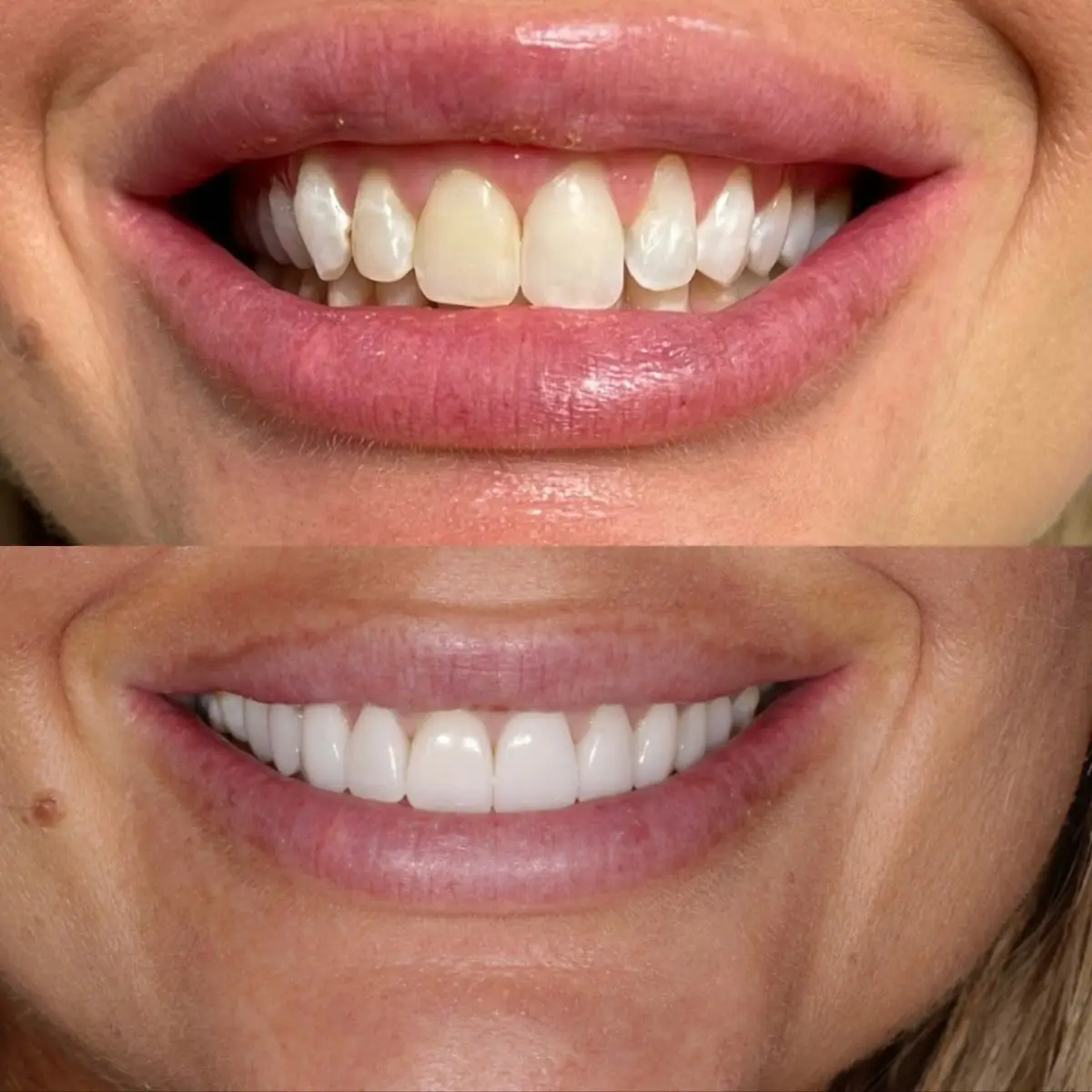 Treatment room at Cedar Smiles Dentistry, Bellflower, Bellflower