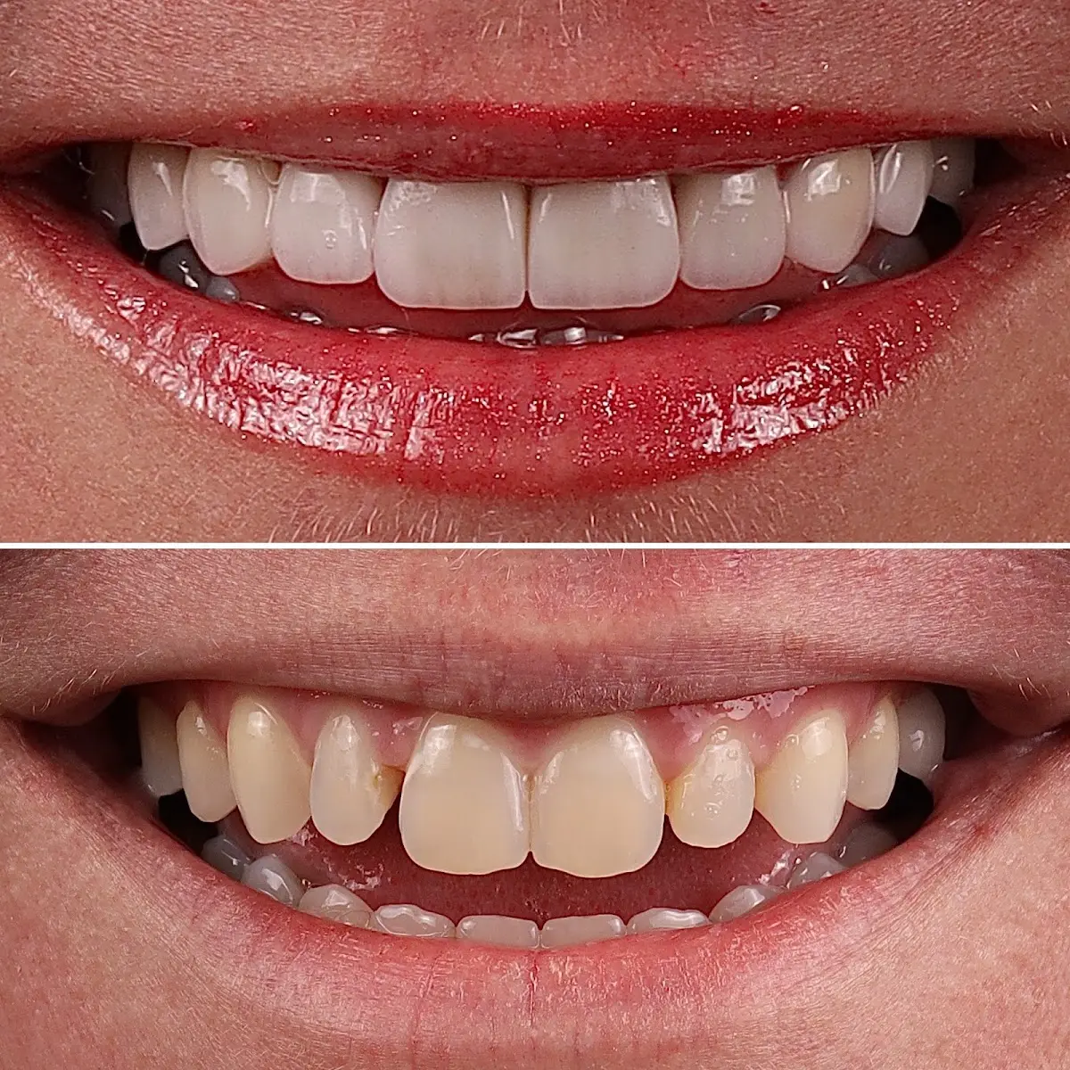 Chairside at Cera Dentistry, Upper Kirby, Houston