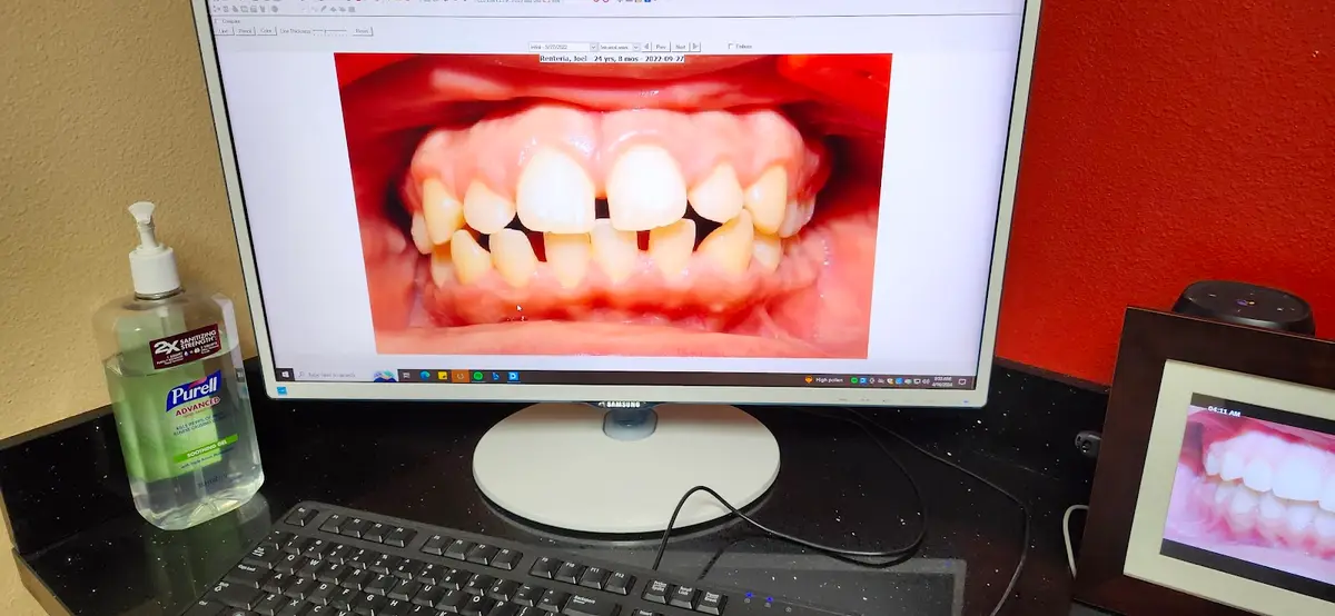 Chairside at Claremont Orthodontics, Claremont, Claremont