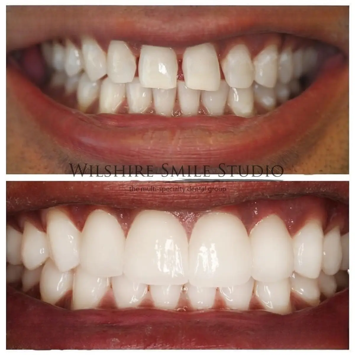 Front entrance of Dental Veneers Specialist On Wilshire - Los Angeles Cosmetic Dentist, Mid Wilshire, Los Angeles