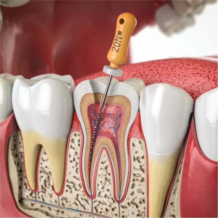 Treatment room at Dental Wellness of Anaheim, Anaheim, Anaheim