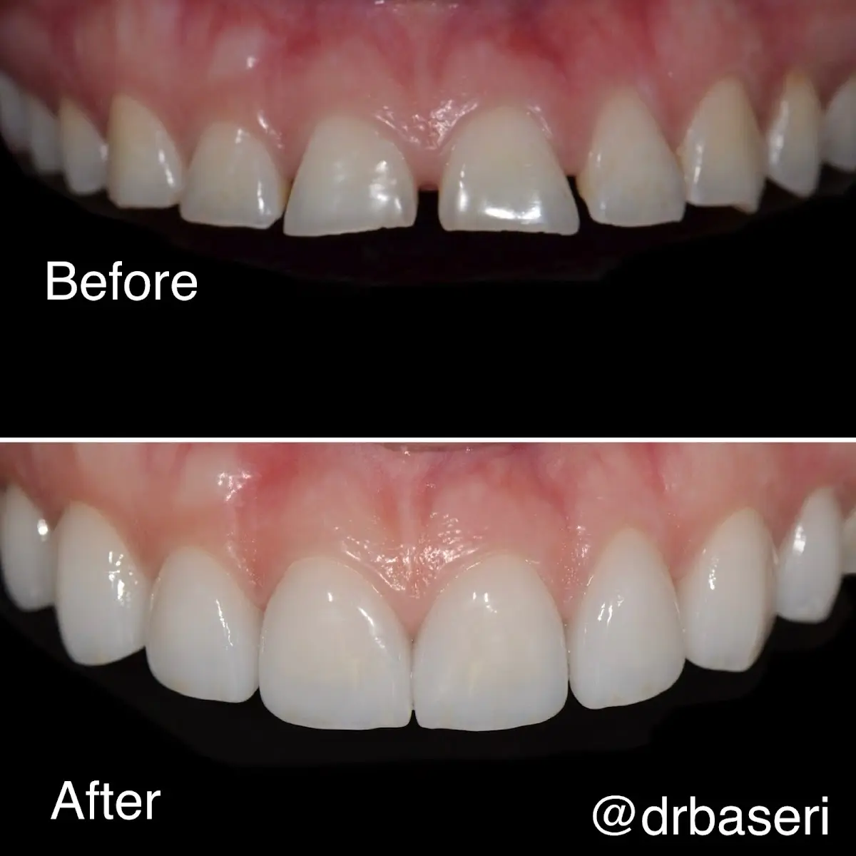 Chairside at Derrick L. Thompson DDS, Mid Wilshire, Los Angeles