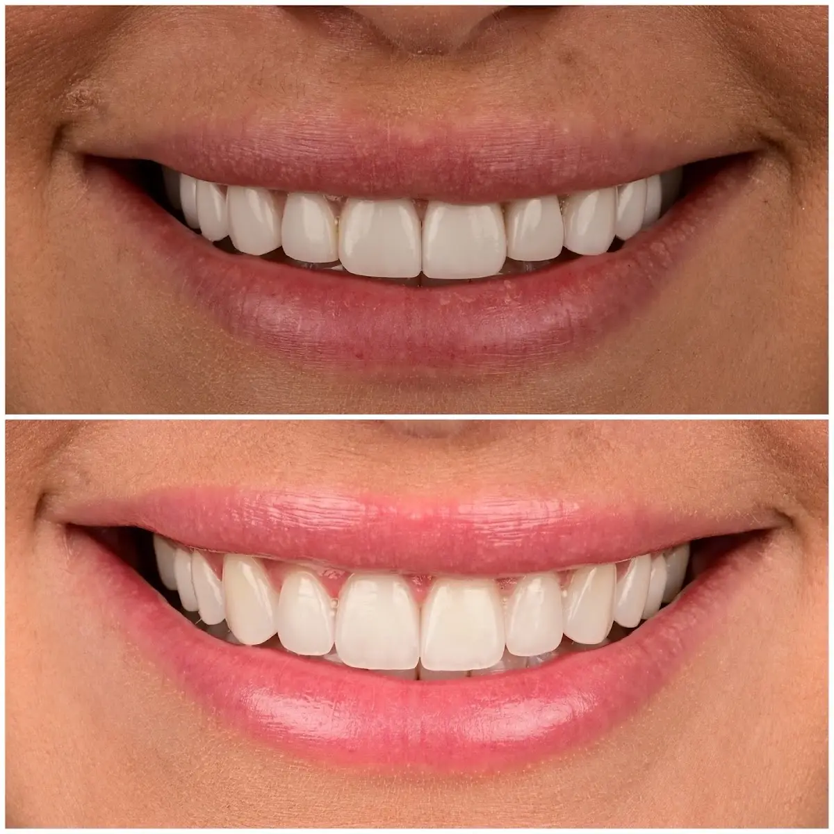 Reception at Dr. Borzoo Ahmadi DDS - Cosmetic Dentist, West Hollywood, Los Angeles