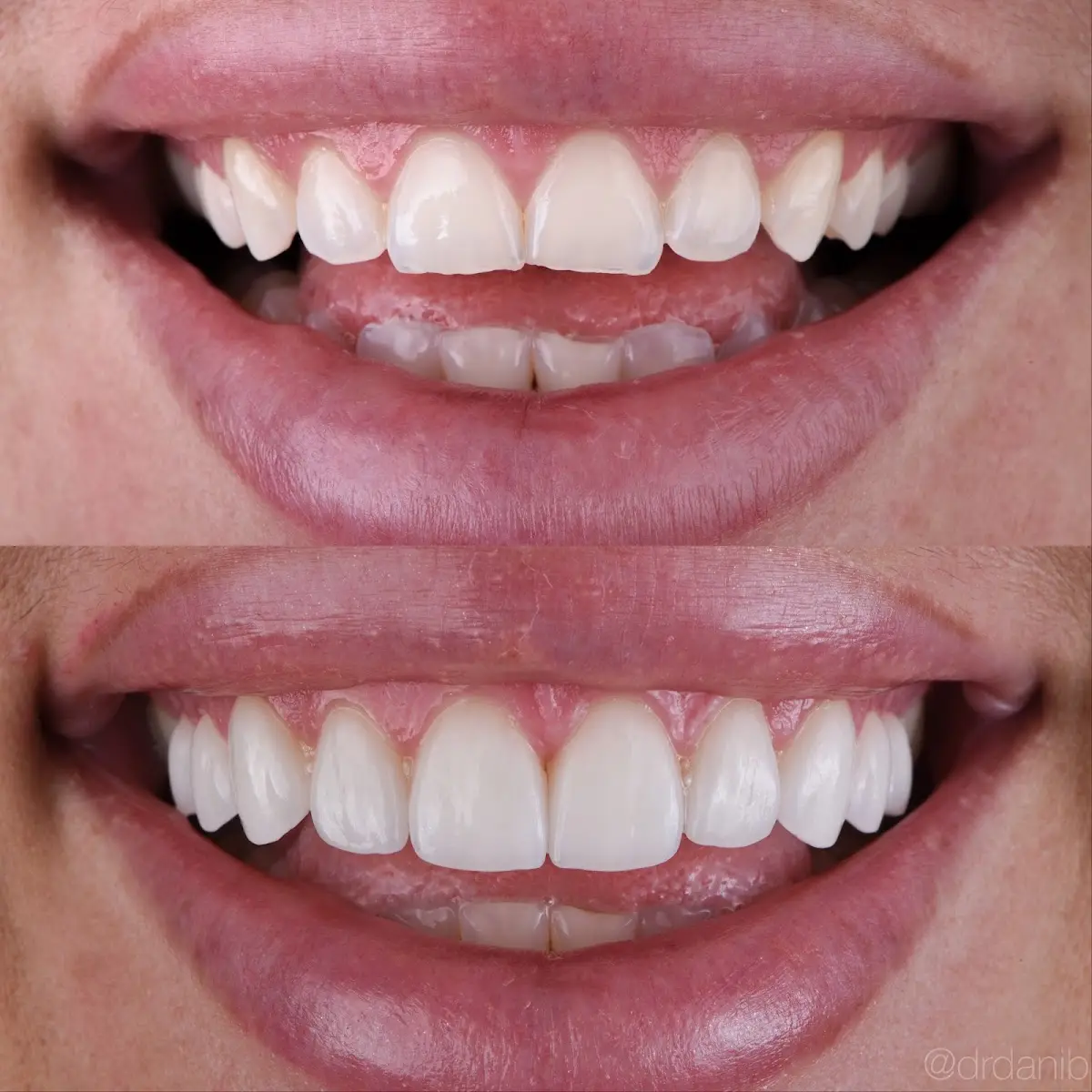 Treatment room at Dr. Dani Benyaminy, DDS, Westwood, Los Angeles