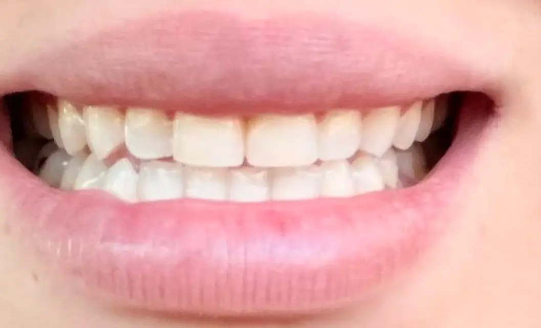 Reception at Dr. Steven Campbell Emergency Dentist Compton 24 Hours, Compton, Compton