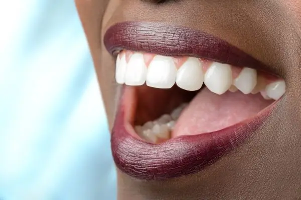 Chairside at Elite Dental Group, Laguna Hills, Laguna Hills