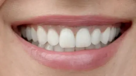 Chairside at Emergency Dentist 24/7 Redondo Beach, Redondo Beach, Redondo Beach