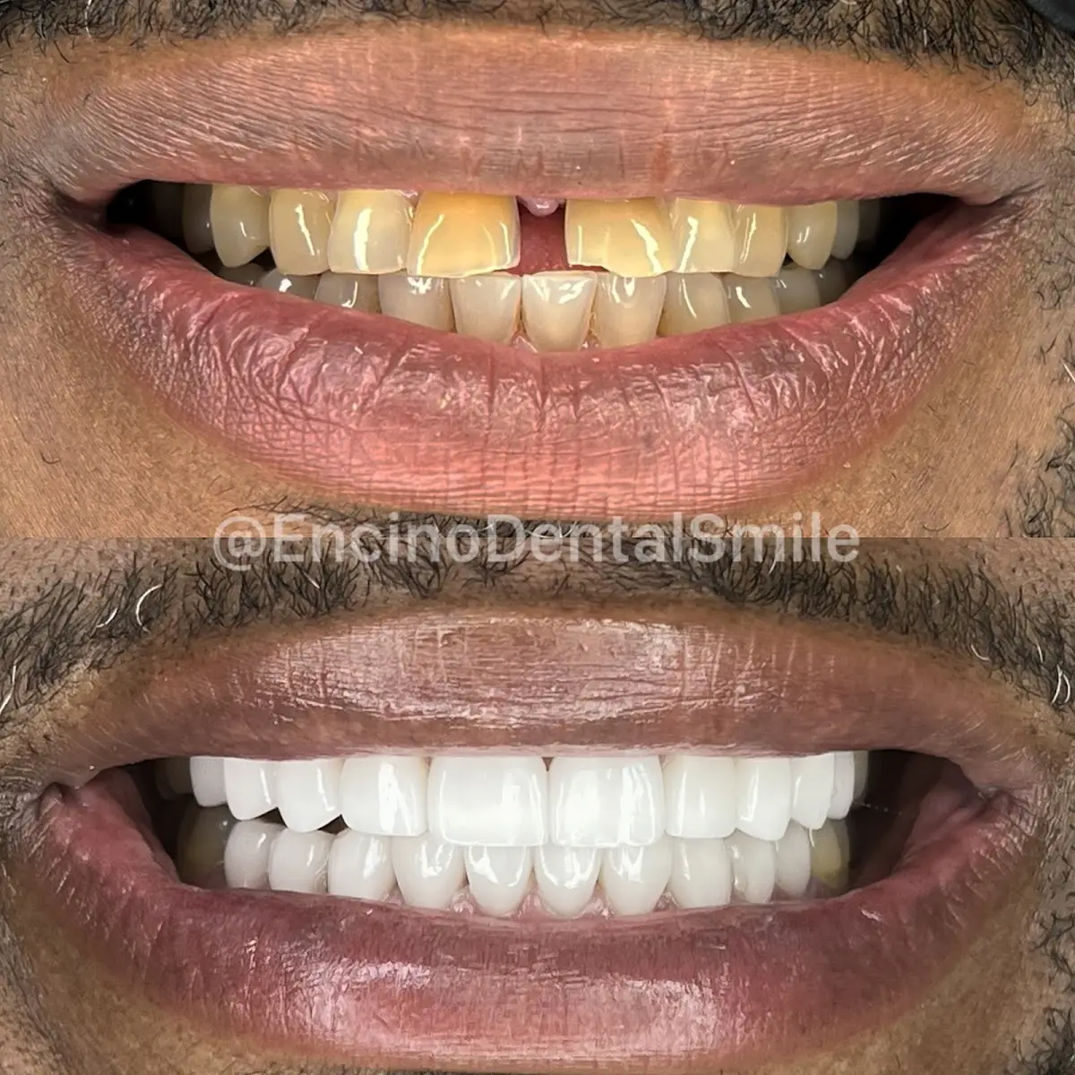 Front entrance of Encino Dental Smile, Encino, Encino