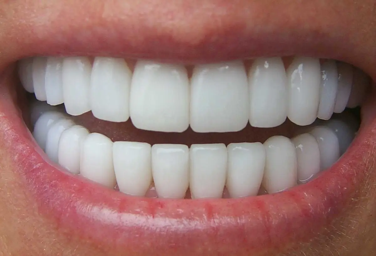 Reception at Excel Dental Orthodontics & Implant Center, Laguna Hills, Laguna Hills