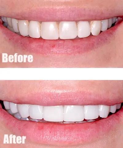 Inside Expert Veneers, Granada Hills, Granada Hills