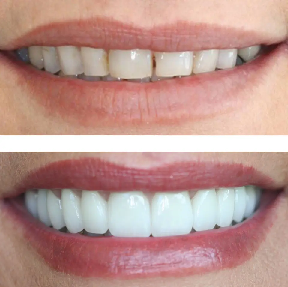 Chairside at Five Star Family Dental - Dr. Vahe Vorperian D.D.S., Reseda, Reseda
