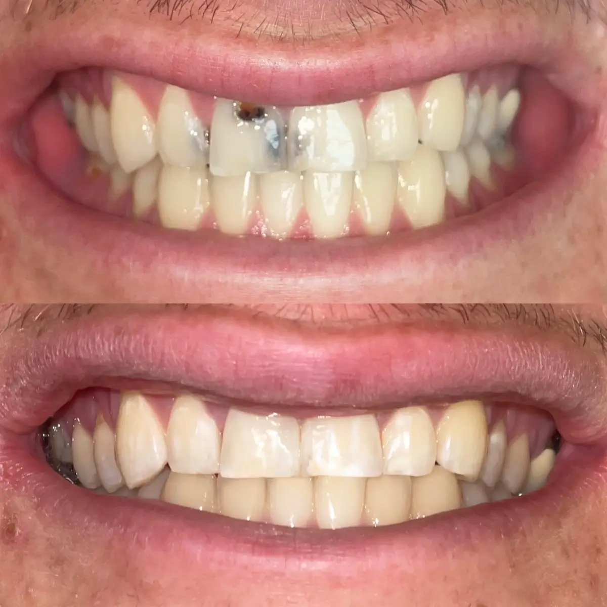 Reception at Harmony Dental care-Cosmetic & Emergency Dentist, Santa Clarita, Santa Clarita