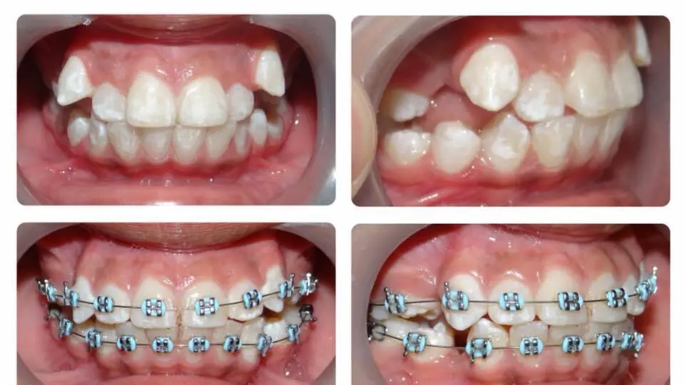 Chairside at Heavenly Dental Smiles Inc., Whittier, Whittier