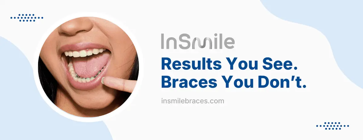 Chairside at InSmile Braces, Fountain Valley, Fountain Valley