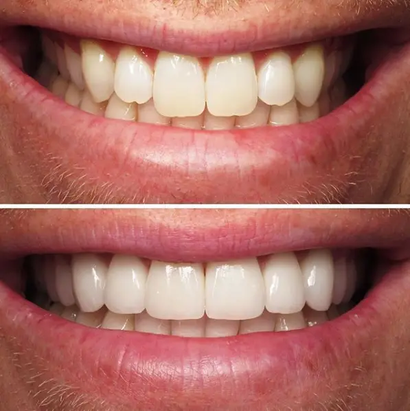 Front entrance of Kevin B. Sands, DDS - Cosmetic Dentistry Beverly Hills, Beverly Hills, Los Angeles