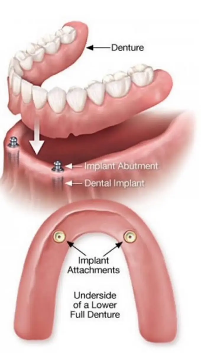 Reception at LAX DENTAL & ORTHODONTICS, Inglewood, Inglewood
