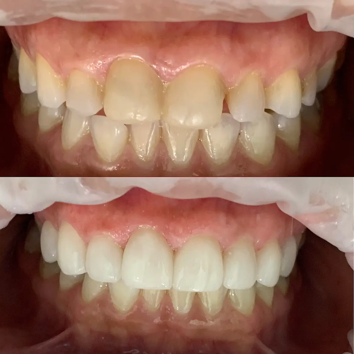 Front entrance of Lux Dental Studio - Houston, Northside Houston, Houston