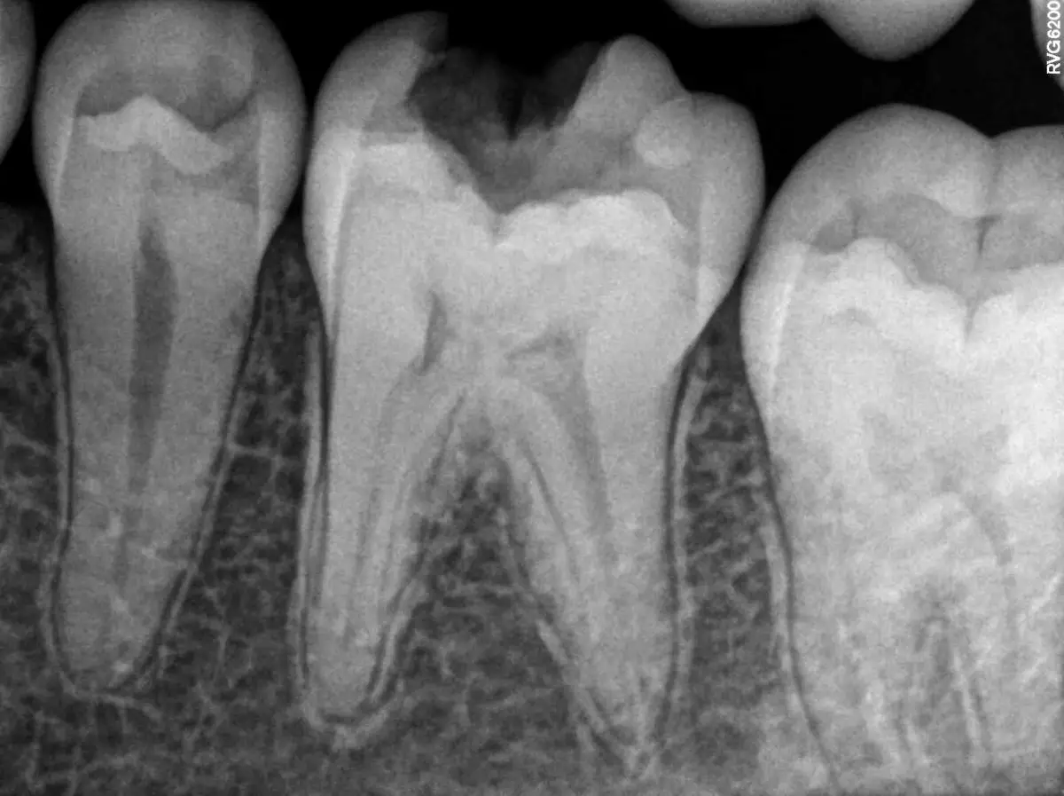 Waiting area at Mid Valley Endodontics, Northridge, Northridge