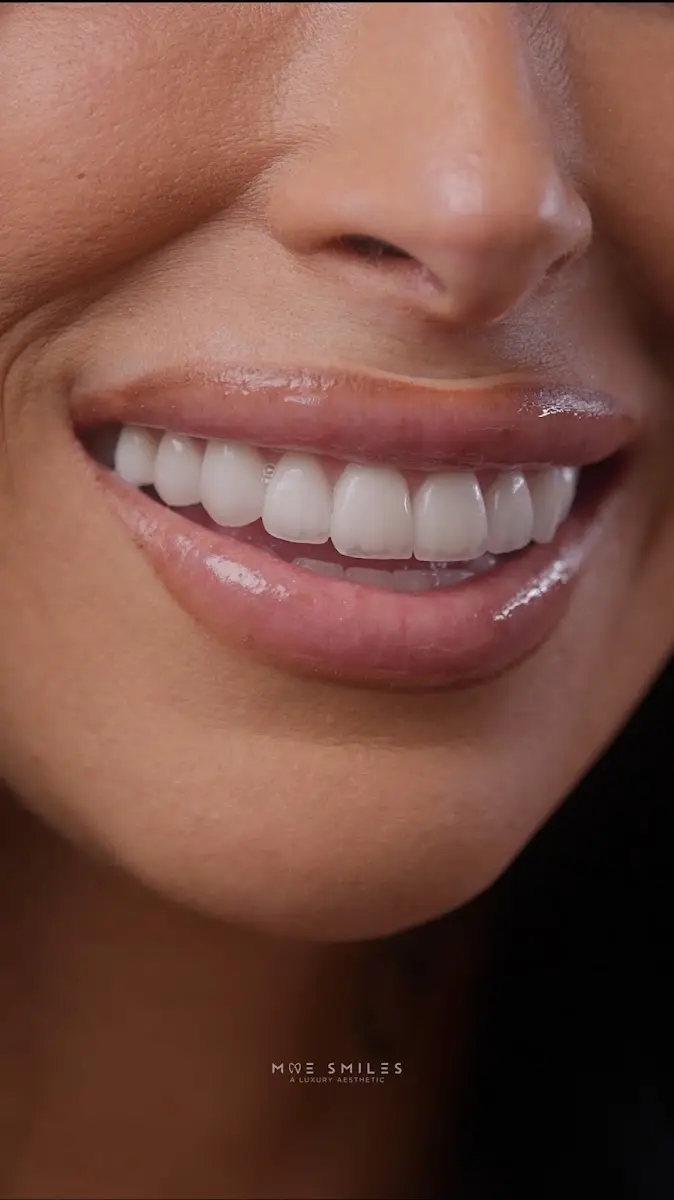 Chairside at Moe Smiles | Luxury Dental Aesthetics, Timbergrove, Houston