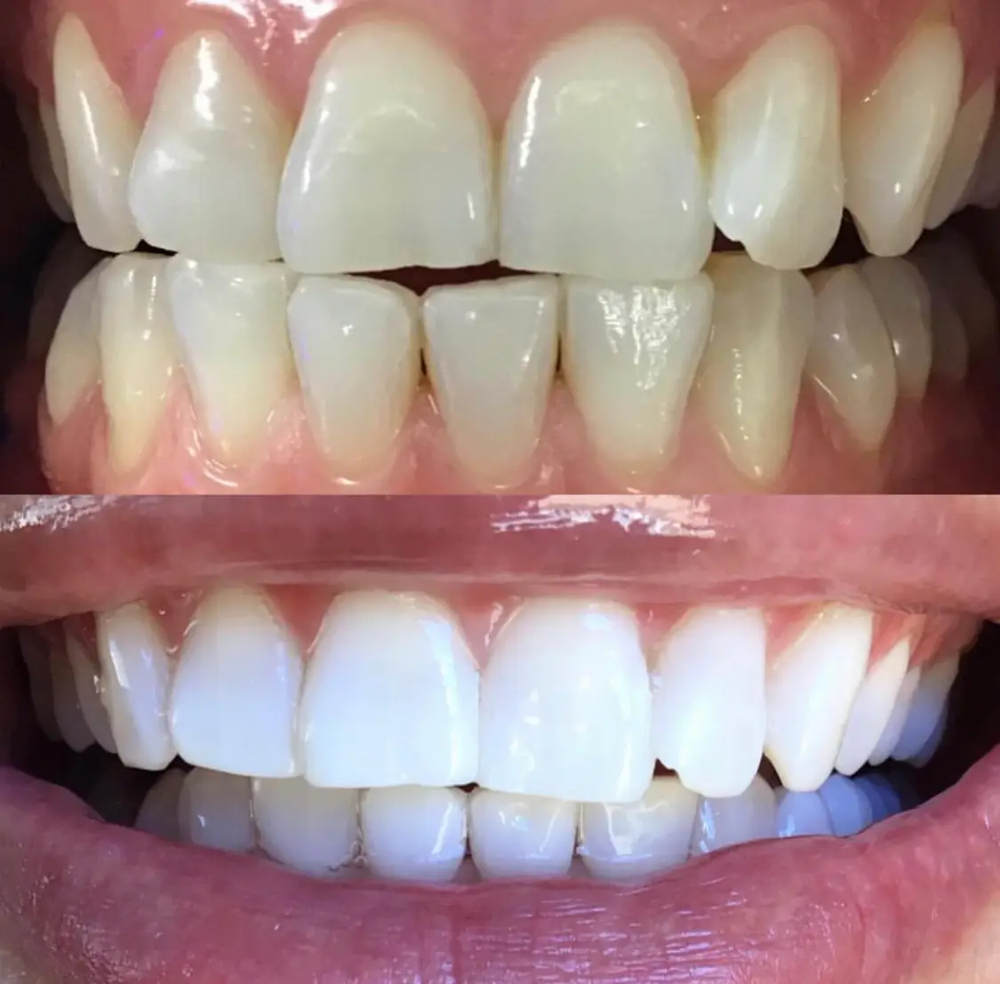 Reception at Naturally White Teeth Whitening, River Oaks, Houston