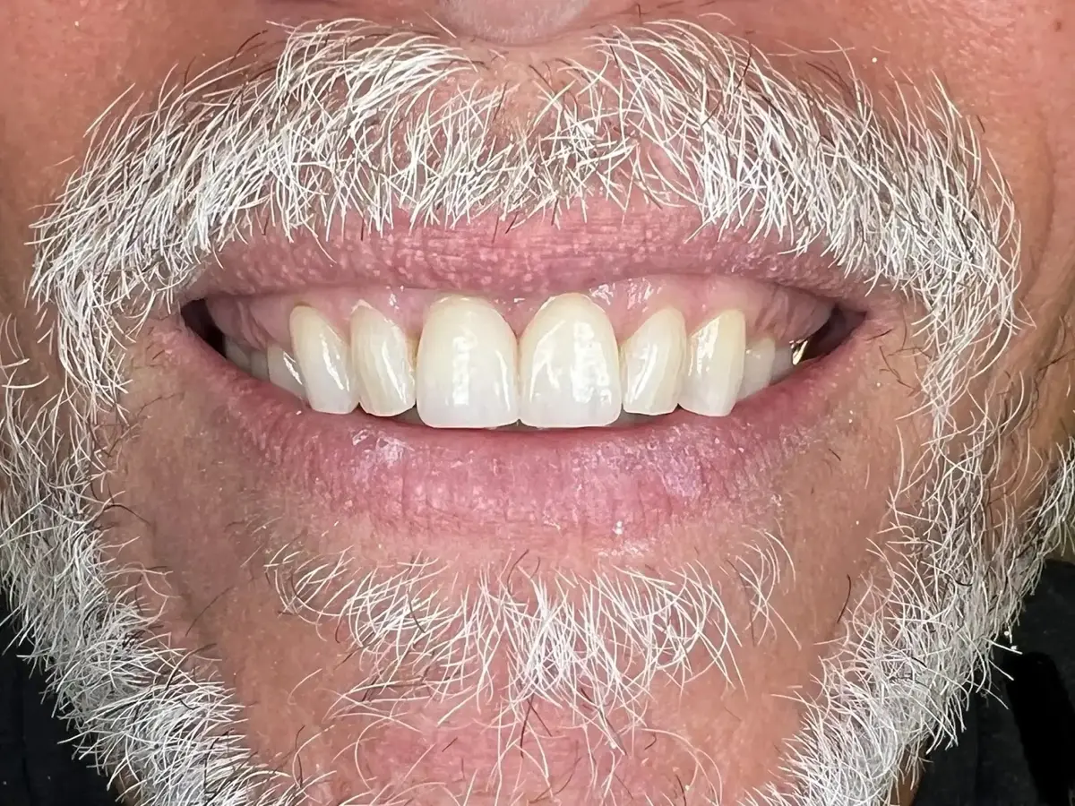 Chairside at Nicole E. Kuske, DDS, Lake Forest, Lake Forest