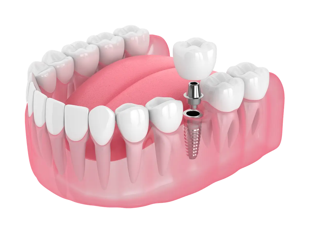 Treatment room at Norwalk Dentistry & Implants, Norwalk, Norwalk
