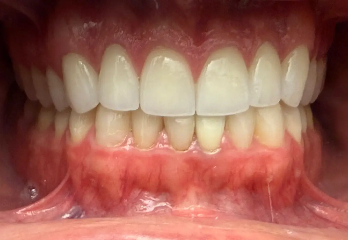 Chairside at Playa Vista Dental Care, Playa Vista, Los Angeles