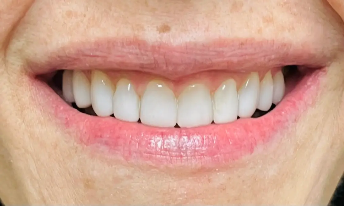 Chairside at Richard O'Braitis DDS, Laguna Niguel, Laguna Niguel