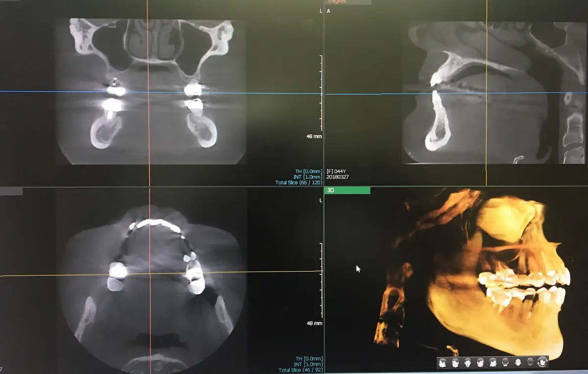 Inside RNA Dentistry: Rozita Nosratabadi, DDS, Westchester, Los Angeles