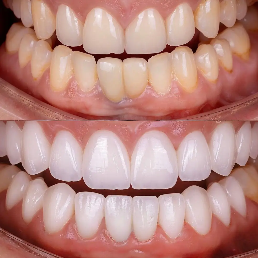 Waiting area at Selfie Smiles Dental, Van Nuys, Van Nuys