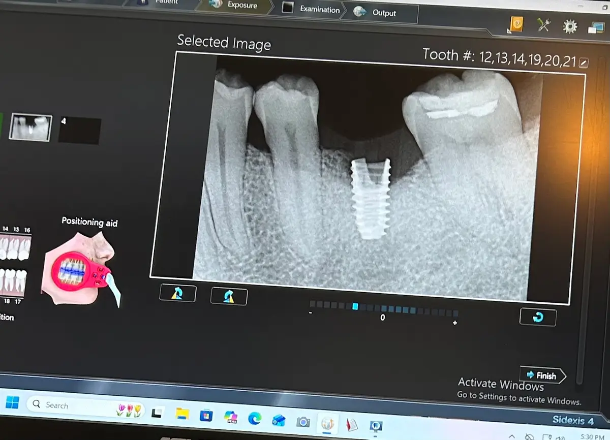 Treatment room at Smile Design: Santa Clarita, Santa Clarita, Santa Clarita