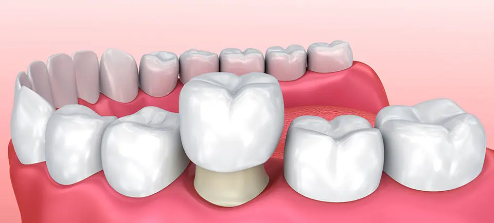 Reception at South Gate Smile Dental, South Gate, South Gate