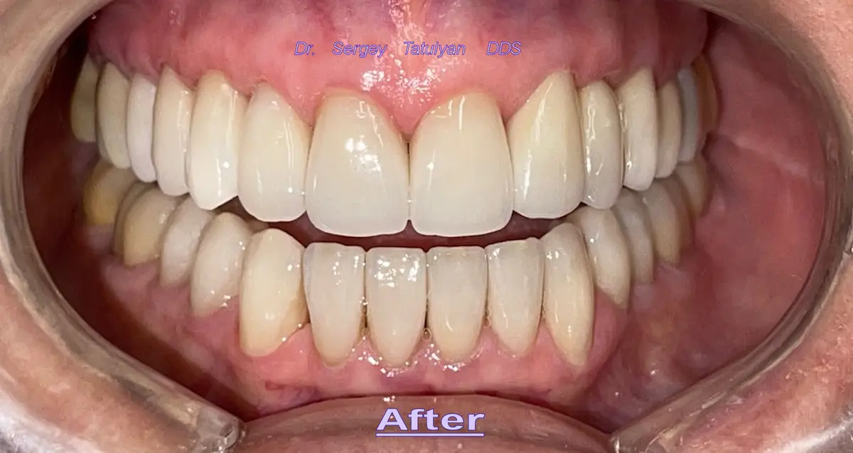 Front entrance of Sterling Smile Dental Care, Northridge, Northridge