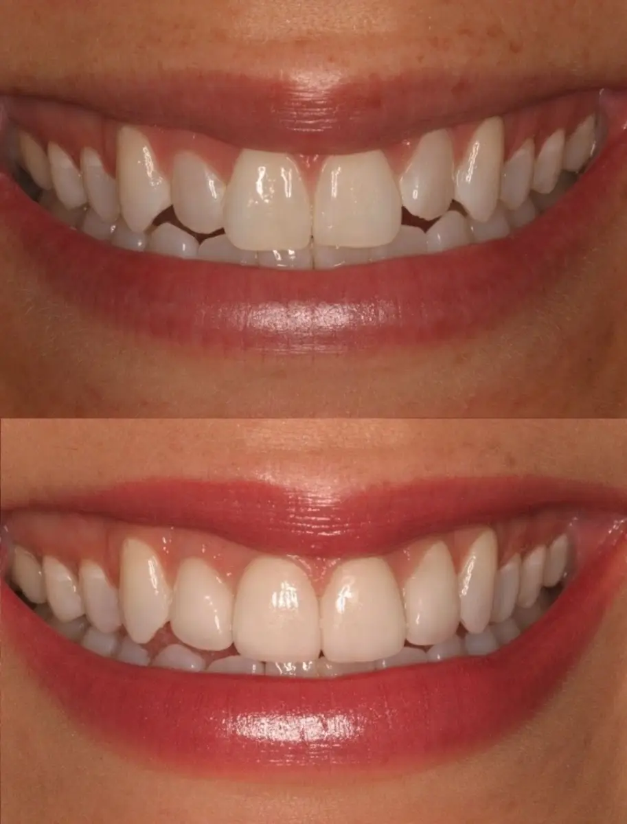 Chairside at Toluca Dental Care: Dr. Nilesh Pema, D.D.S., Toluca Lake, Toluca Lake