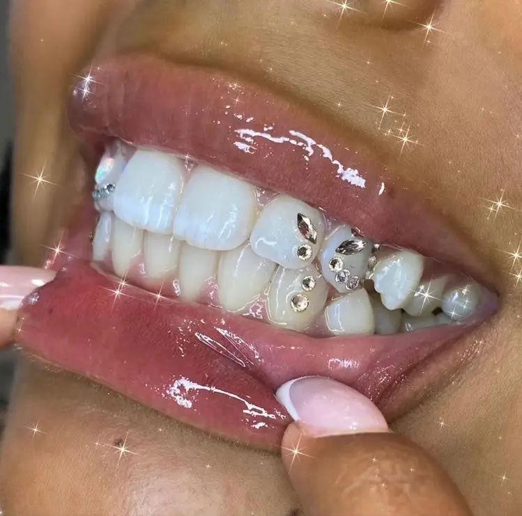 Treatment room at Tooth Gems @ Boss Baby, Willowbrook, Houston