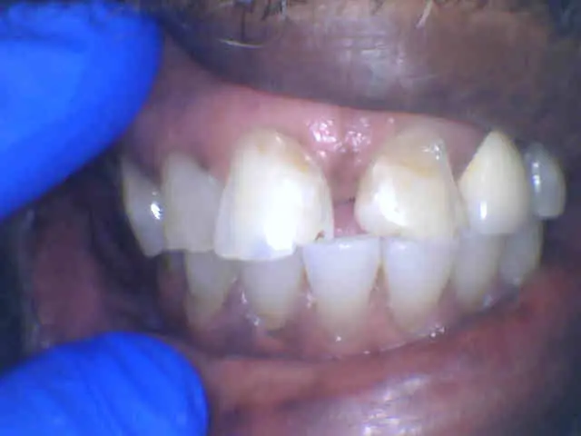 Treatment room at Universal Care: Espinoza Maria DDS, Lynwood, Lynwood