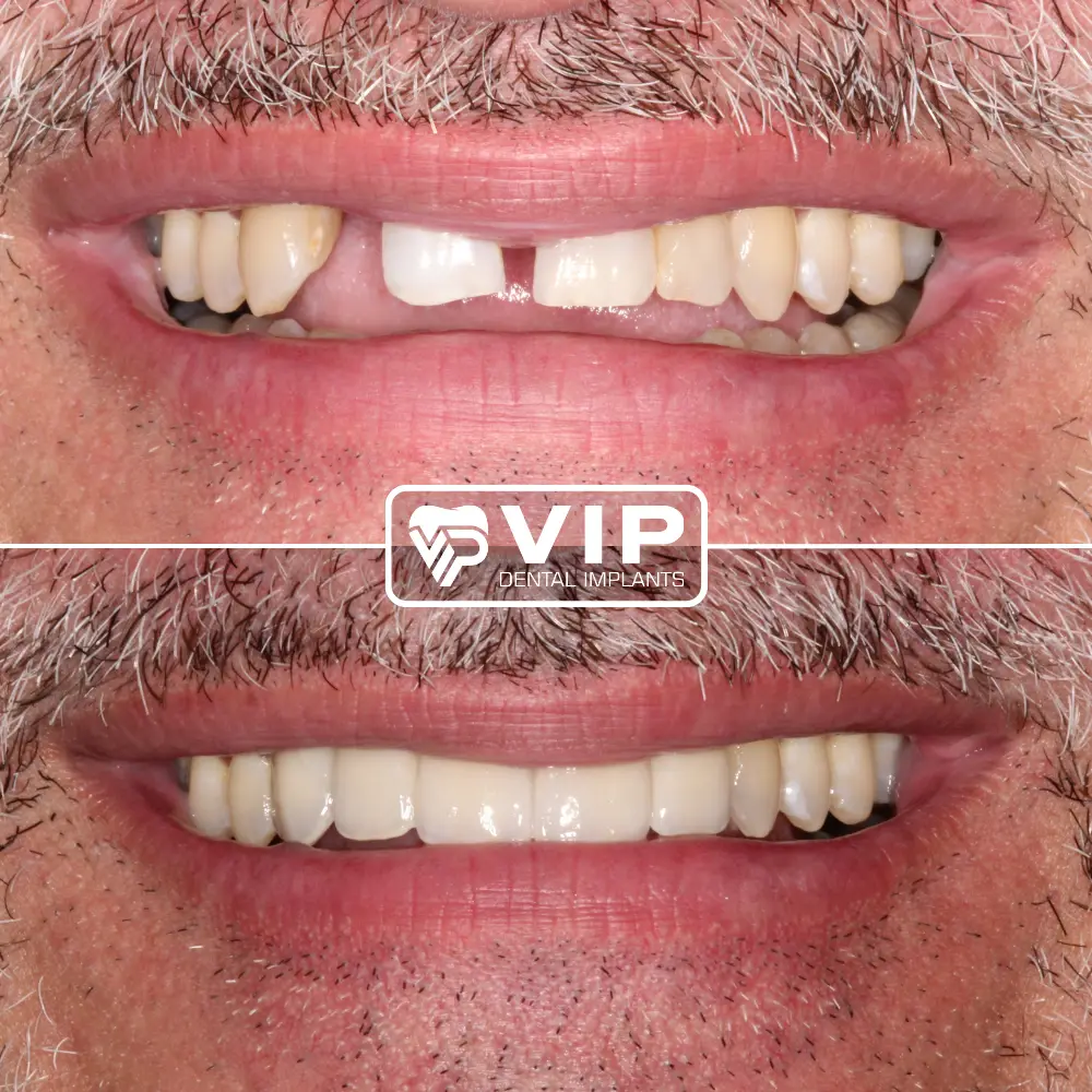 Treatment room at VIP Dental Implants CityCentre, Memorial, Houston