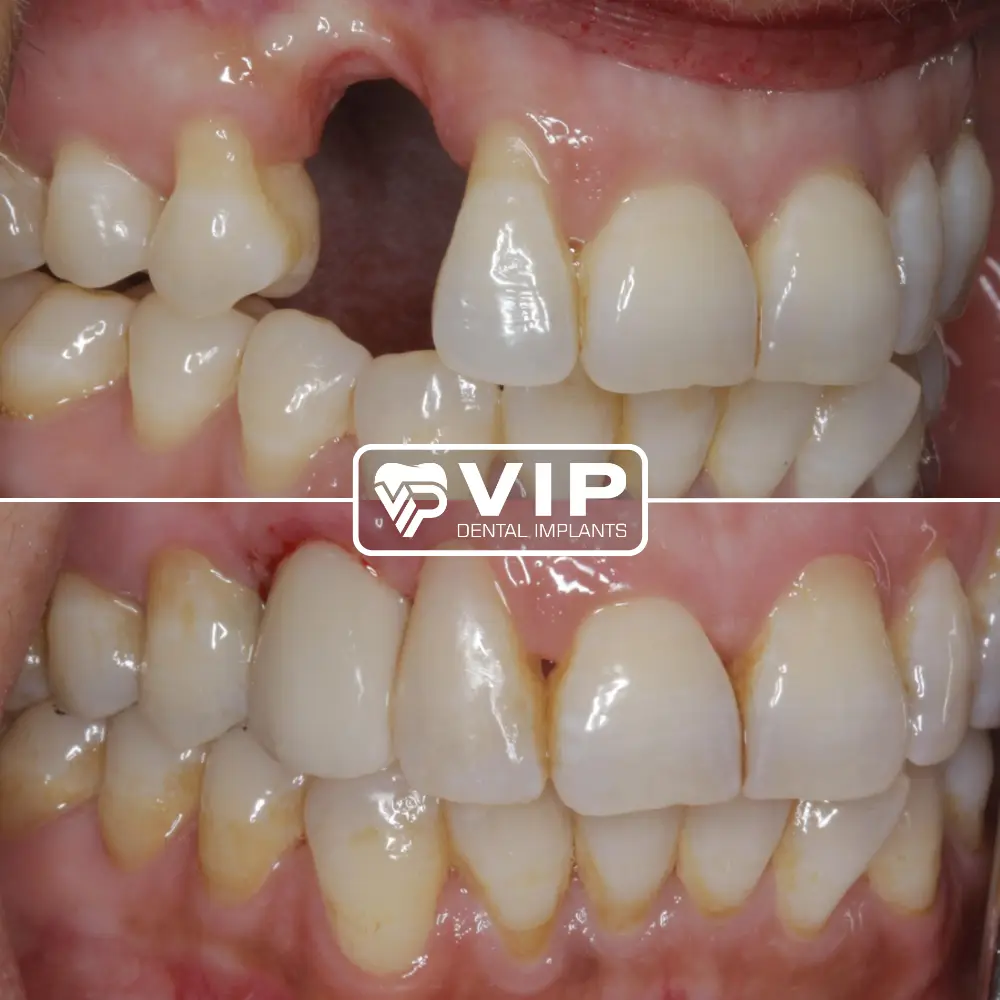 Inside VIP Dental Implants West U, Upper Kirby, Houston