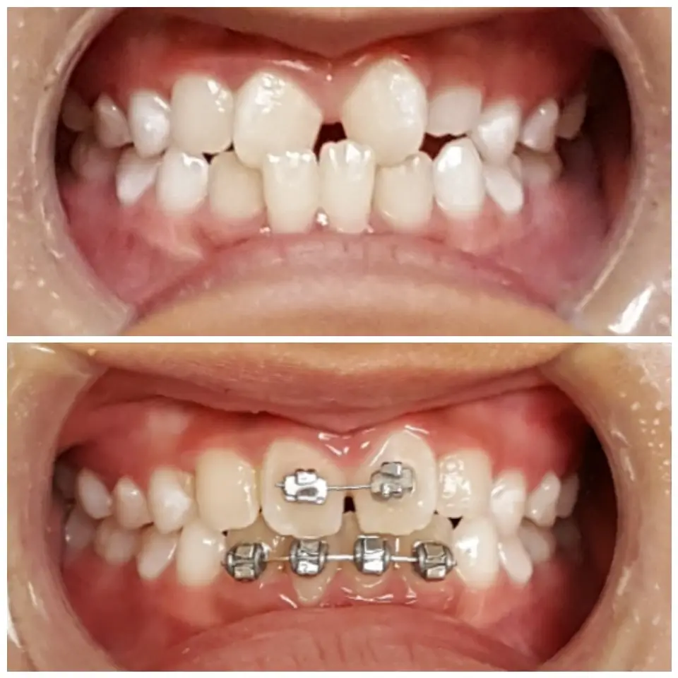 Inside Warner Dental - Fountain Valley, Fountain Valley, Fountain Valley